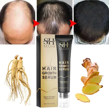 Ilgalaikis Plaukų Augimo Serumas Skystis Greitai Auga Plaukai Massager Kelią Nuplikimas Gydymas Anti Plaukai, Slinkimas, Galvos Odos Masažas Plaukų Priežiūra